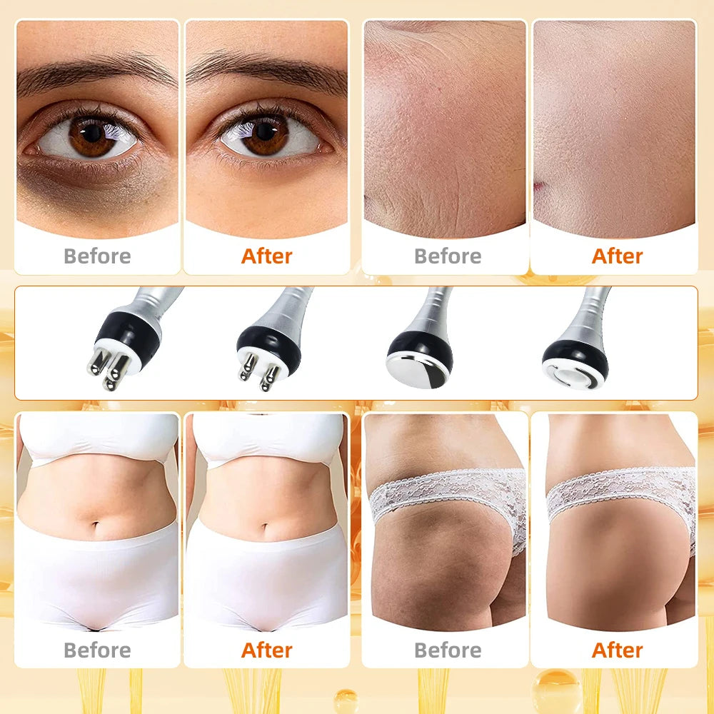 4IN1 Cavitation Body Slimming 40K Machine Beauty Massager Skin Tighten Face Lifting Vacuum Suction
